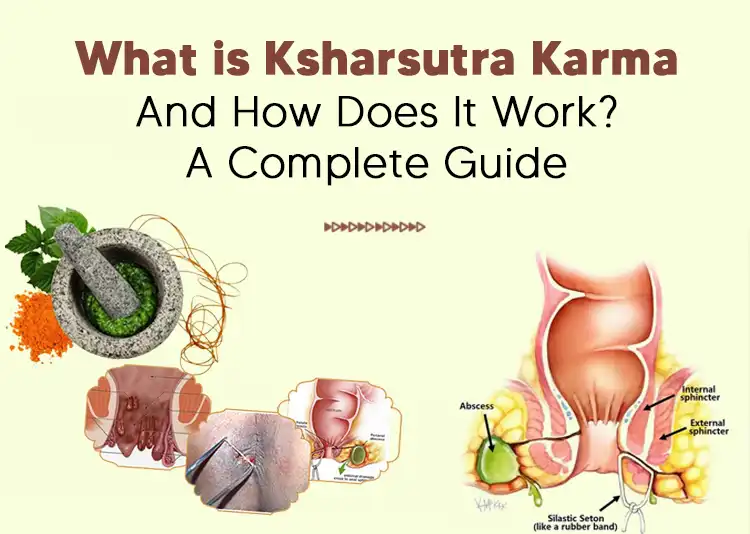 What is Ksharsutra Karma and How Does It Work? A Complete Guide